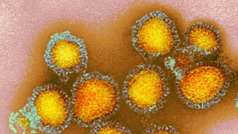 Electron microscopy image of influenza viruses. CREDIT: CDC/Science Photo Library
